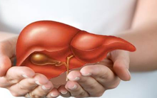 5 thực phẩm âm thầm ‘tàn phá’ gan rất phổ biến trong ngày Tết: Số 1 có thể gây ung thư