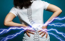 3 loại ung thư có dấu hiệu sớm là đau lưng kéo dài, tiếc là ai cũng bỏ qua vì tưởng bệnh vặt