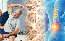 4 bổ sung, 2 hạn chế người sau 30 tuổi rất cần lưu ý để tránh "cơn ác mộng" loãng xương