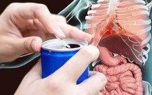 WHO liệt kê những nguy hiểm khi tiêu thụ nhiều nước tăng lực, từ răng miệng đến viêm gan cấp tính