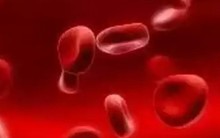 Mỹ phê duyệt loại thuốc đắt nhất thế giới, giá 3,5 triệu USD/liều