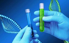 Bệnh viện Phụ sản Hà Nội: Công bố ca song thai cùng trứng cực kỳ đặc biệt, thế giới mới ghi nhận 1 trường hợp