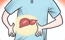 Bác sĩ chỉ rõ 4 loại “thịt” mà bệnh nhân viêm gan B cần tránh, 1 loại cần ăn nhiều để gan khỏe mạnh hơn