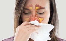 2 tình trạng dị ứng thường gặp khi trời chuyển lạnh và 7 việc cần làm để tránh gặp biến chứng nguy hiểm