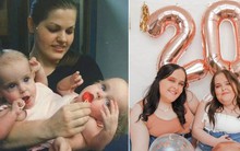 Từng là cặp chị em song sinh dính liền bụng nổi tiếng, cuộc sống của cả hai sau khi được tách đôi giờ ra sao?