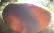 15 phút sau khi chui khỏi vỏ trứng, sinh vật này có thể giết chết người: Chúng là loài gì?