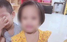 Sức khỏe bé gái 3 tuổi bị nhân tình của mẹ đóng đinh vào đầu hiện ra sao?