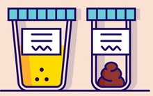 5 biểu hiện lúc thức dậy vào buổi sáng cho thấy bạn có một cơ thể rất khỏe mạnh