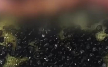 485 viên sỏi được lấy ra khỏi túi mật của chàng trai 28 tuổi sau khi bị đau bụng, nôn mửa, nguyên nhân đến từ 2 thói quen mà hầu hết người trẻ mắc phải