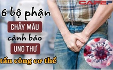 Sau 40 tuổi, 6 bộ phận bỗng "đổ máu" cảnh báo ung thư đang "tấn công" cơ thể: Khi sức khỏe bật đèn đỏ, xin đừng thờ ơ