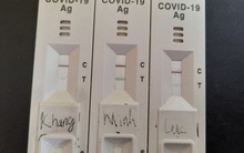 F0 có cần test nhanh Covid hằng ngày? Chuyên gia trả lời, chỉ ra 2 thời điểm cần test