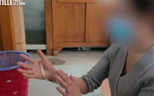 Tay phải của người phụ nữ bị liệt sau khi ngủ trưa 1 giờ, chuyên gia chỉ ra 3 tư thế ngủ có thể làm ''dập nát'' dây thần kinh mà nhiều người mắc phải