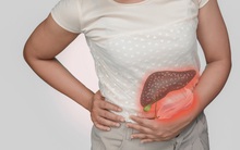 4 chứng “viêm” tưởng chừng nhỏ nhặt lại có thể phát triển thành ung thư nguy hiểm: Điều trị sớm kẻo hối không kịp!