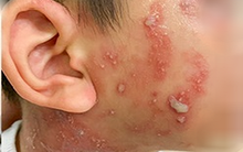 Hai mẹo đuổi kiến ba khoang sạch bách, không lo độc hại