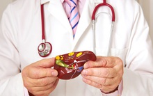 Ung thư gan diễn biến âm thầm nhưng cực kỳ nguy hiểm: Bác sĩ cảnh báo nguyên nhân vô vàn, ai cũng có thể là nạn nhân