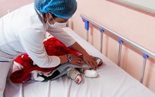 Xông mũi họng để phòng COVID-19, bé trai 6 tháng tuổi bị bỏng, nhiễm trùng máu