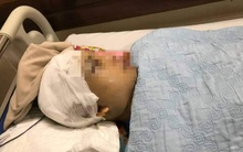 Tạm giữ 2 đối tượng đánh Phó Chủ tịch xã vỡ hộp sọ ở Hải Dương