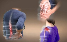 4 loại thực phẩm là "vua ăn mòn xương", ăn thường xuyên rút cạn canxi, xương răng yếu đi trông thấy, tác động nhẹ cũng có thể gãy