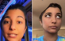 Cô gái 25 tuổi phải cắt nửa hộp sọ, suýt mất mạng chỉ từ một triệu chứng sức khỏe nhỏ ai cũng gặp mà toàn mặc định bỏ qua luôn