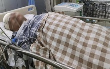 Chàng trai 23 tuổi đang khỏe mạnh bỗng lên cơn đột quỵ, liệt nửa người vì có 5 thói xấu trong sinh hoạt hằng ngày