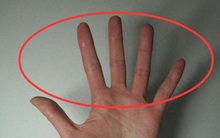 Có 3 cách tự kiểm tra sức khỏe phổi tại nhà, nếu có biểu hiện "1 chậm, 2 nhanh, 3 hơn" thì cần đi khám phổi càng sớm càng tốt