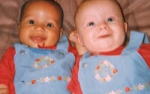 Cặp chị em sinh đôi “khác nhau nhất thế giới” trái ngược từ màu da đến mái tóc từng gây xôn xao khó hiểu giờ trông thế nào sau 25 năm?