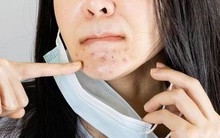 Cách chăm sóc da khi thường xuyên phải đeo khẩu trang mùa nắng nóng