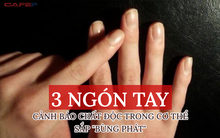 3 triệu chứng trên ngón tay cảnh báo cơ thể tích tụ toàn chất độc sắp bùng phát, ung thư gan, phổi đang rình rập