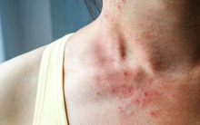 Chỉ cần có 2 đồ vật này trong nhà, bạn có thể tự cứu cả gia đình thoát khỏi tử thần