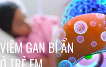 Bộ Y tế khuyến cáo cách phòng chống bệnh viêm gan cấp tính 'bí ẩn' ở trẻ em