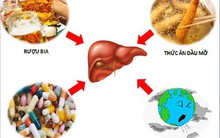 7 thói quen 'bào mòn' lá gan từng ngày, cứ kéo dài chẳng mấy mà ung thư gan