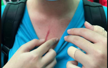 Bộ GD&ĐT đề nghị TPHCM xử lý vụ phụ huynh tố con bị đánh ở trường quốc tế