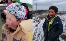 “Cậu bé đóng băng” từng làm lay động bao người: Cuộc sống thay đổi hoàn toàn sau khi trở thành biểu tượng nghị lực