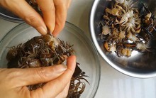 Trẻ sốt xuất huyết: Lưu ý từ ngày 3 đến ngày 7 của bệnh nếu không muốn con gặp nguy hiểm