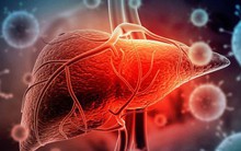 Bộ Y tế yêu cầu tăng cường giám sát bệnh viêm gan cấp tính gây tử vong ở trẻ