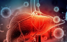 Tăng cường lấy mẫu xét nghiệm các ca nghi ngờ viêm gan cấp tính không rõ nguyên nhân