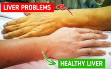 Bạn nên chú ý sức khỏe khi cơ thể phát ra những dấu hiệu này