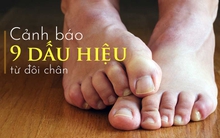 Bàn chân là "trái tim thứ 2" trên người: Nếu xuất hiện 9 thay đổi này, có thể cơ thể đang gặp nhiều bất ổn