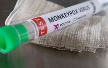 Anh xác nhận đậu mùa khỉ lây lan trong cộng đồng