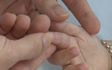 Nguyên tắc "3 sạch" phòng bệnh tay chân miệng