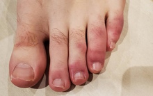 2 phần cơ thể thường xuyên bị nhiễm lạnh cảnh báo thận yếu, bị tổn thương: Nam giới muốn khỏe mạnh thì nên làm 3 và tránh xa 2 thói quen này