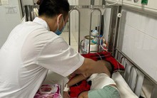 Lo ngại viêm não sau cúm A