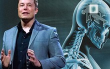 Elon Musk đã "copy" thành công não của chính mình