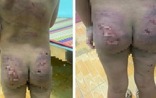 Từ vụ bé 7 tuổi bị cha mẹ bạo hành, Chủ tịch tỉnh Bình Phước chỉ đạo khẩn