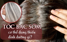 Chưa già tóc đã bạc trắng, có thể bạn cần bổ sung ngay một loại dinh dưỡng quan trọng