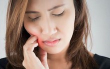 Miệng bị khô và đắng khi ngủ ban đêm thì cần đi khám ngay vì có thể bạn đang mắc 5 bệnh này