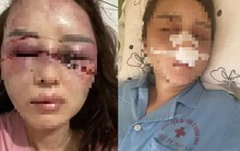 Cán bộ QLTT đánh đập bạn gái dã man vì hát song ca đã có vợ con