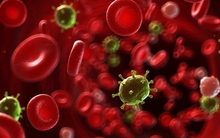 Những dấu hiệu cảnh báo bệnh ung thư máu, bạn nhất định không được bỏ qua