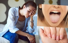 9 dấu hiệu sức khoẻ cảnh báo bạn đang ăn uống quá mức nghèo nàn, phải bổ sung dinh dưỡng ngay lập tức