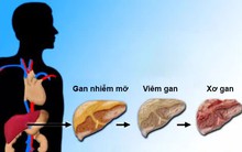 Mùa hè, gan thích nhất những thực phẩm này, nên bổ sung ngay để kéo dài tuổi thọ